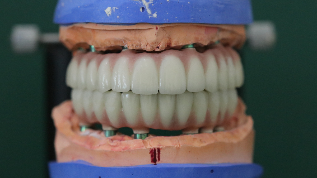 proteza, NFZ, świadczenie, refundacja, zarządzenie