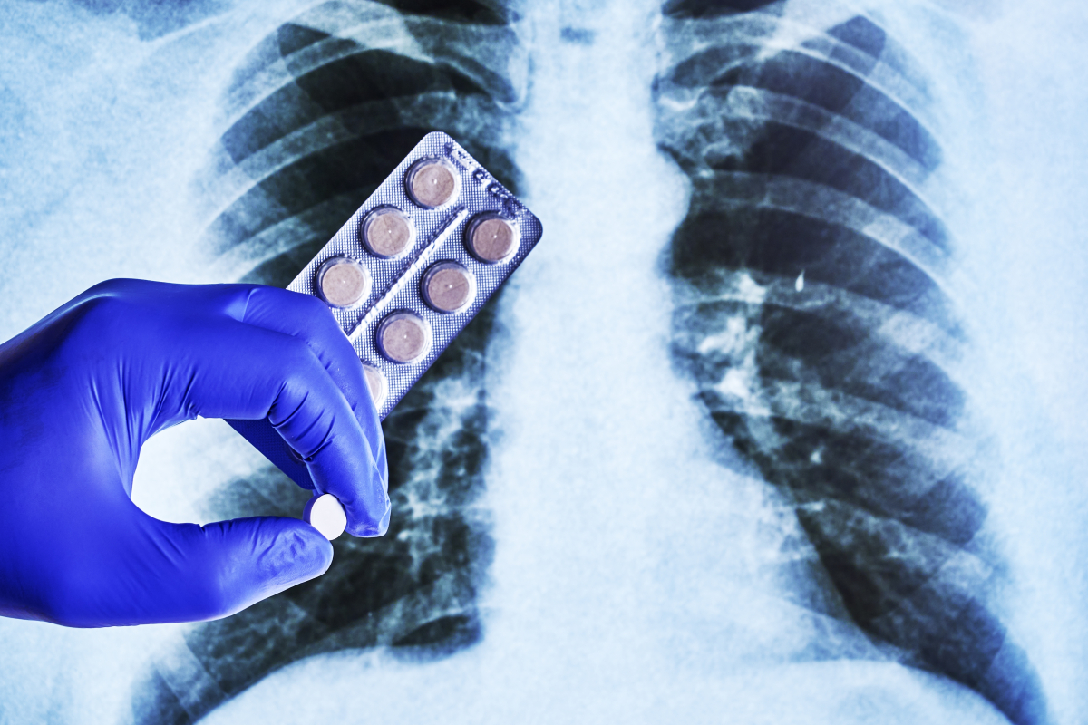 Nawroty raka i gorsza terapia. Onkolodzy ostrzegają przed paleniem po diagnozie
