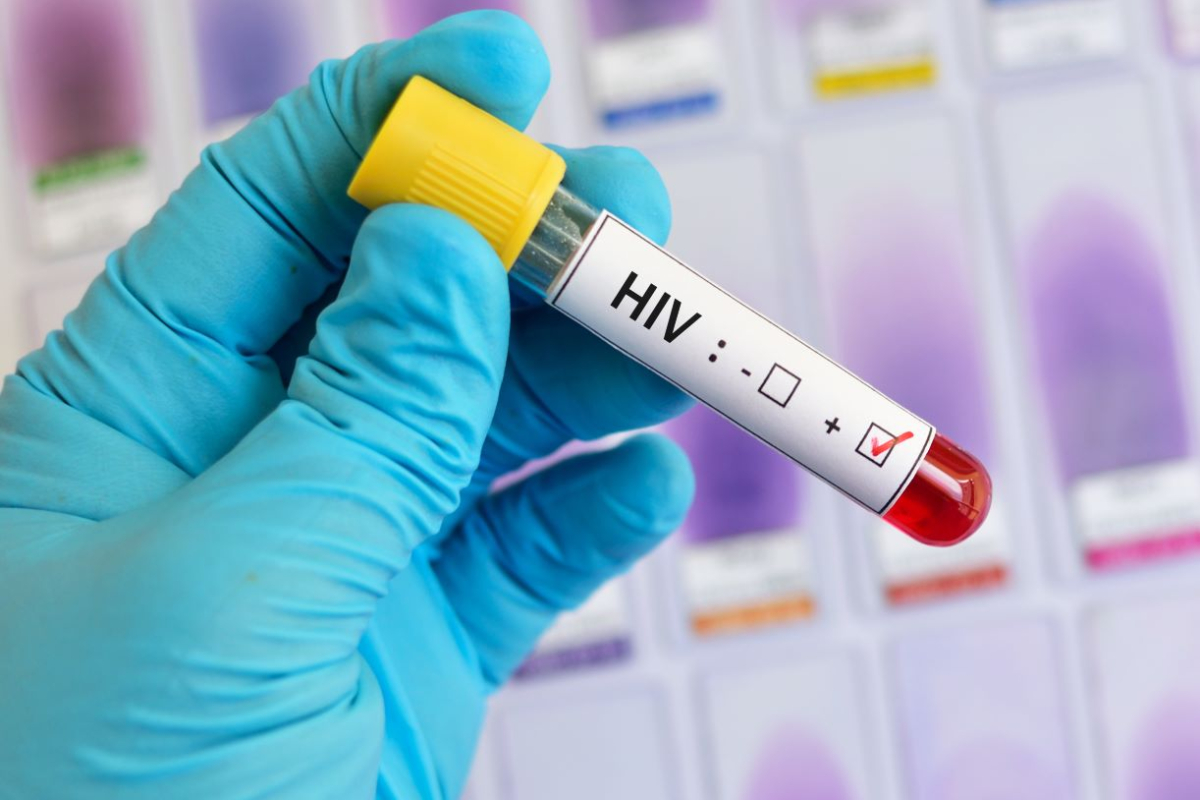 Przełom w badaniach nad HIV. Naukowcy odkryli, jak wirus zakaża „uśpione” komórki odpornościowe