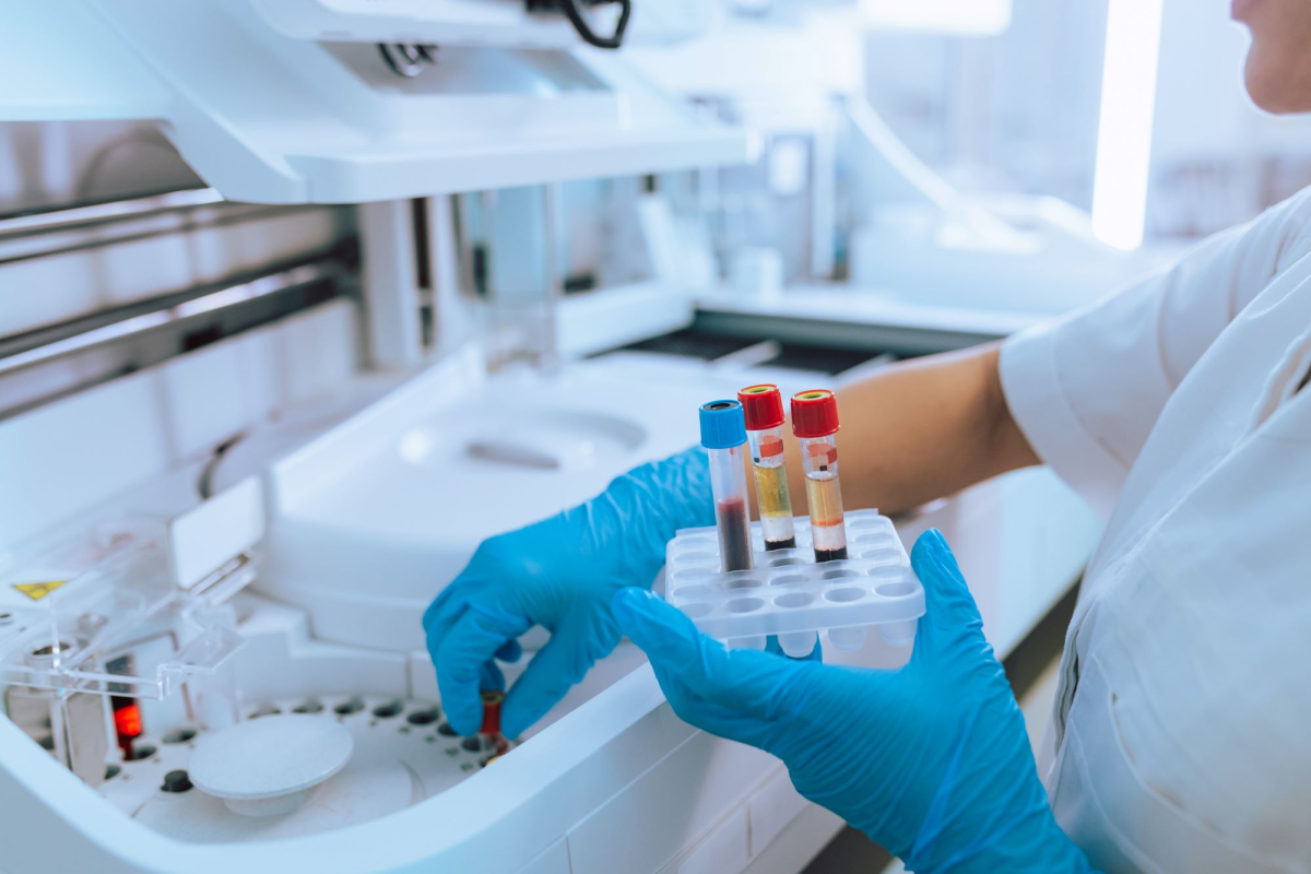 Badanie lipoproteina A