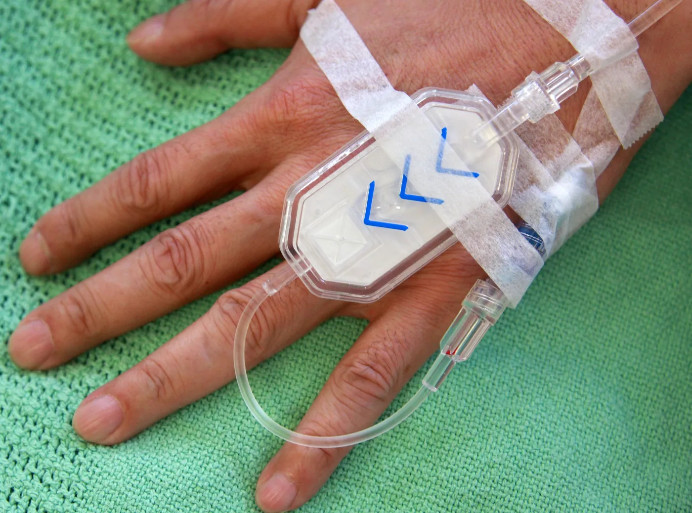 Wiele zależy od wczesnej diagnozy. OBJAWY RAKA KRWI