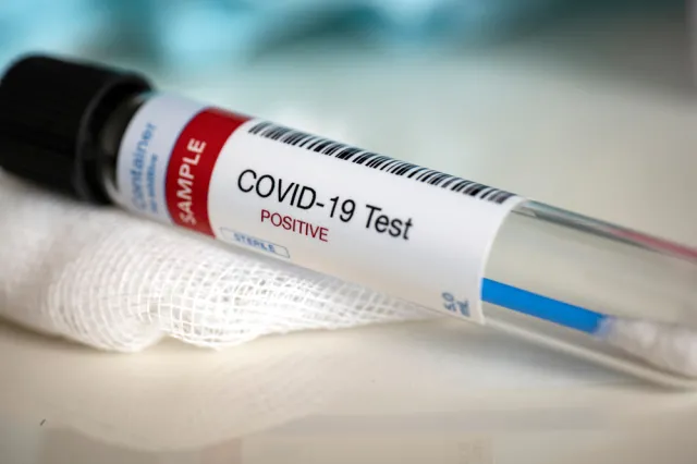 Lekarze apelują, by nie unikać testów na Covid-19