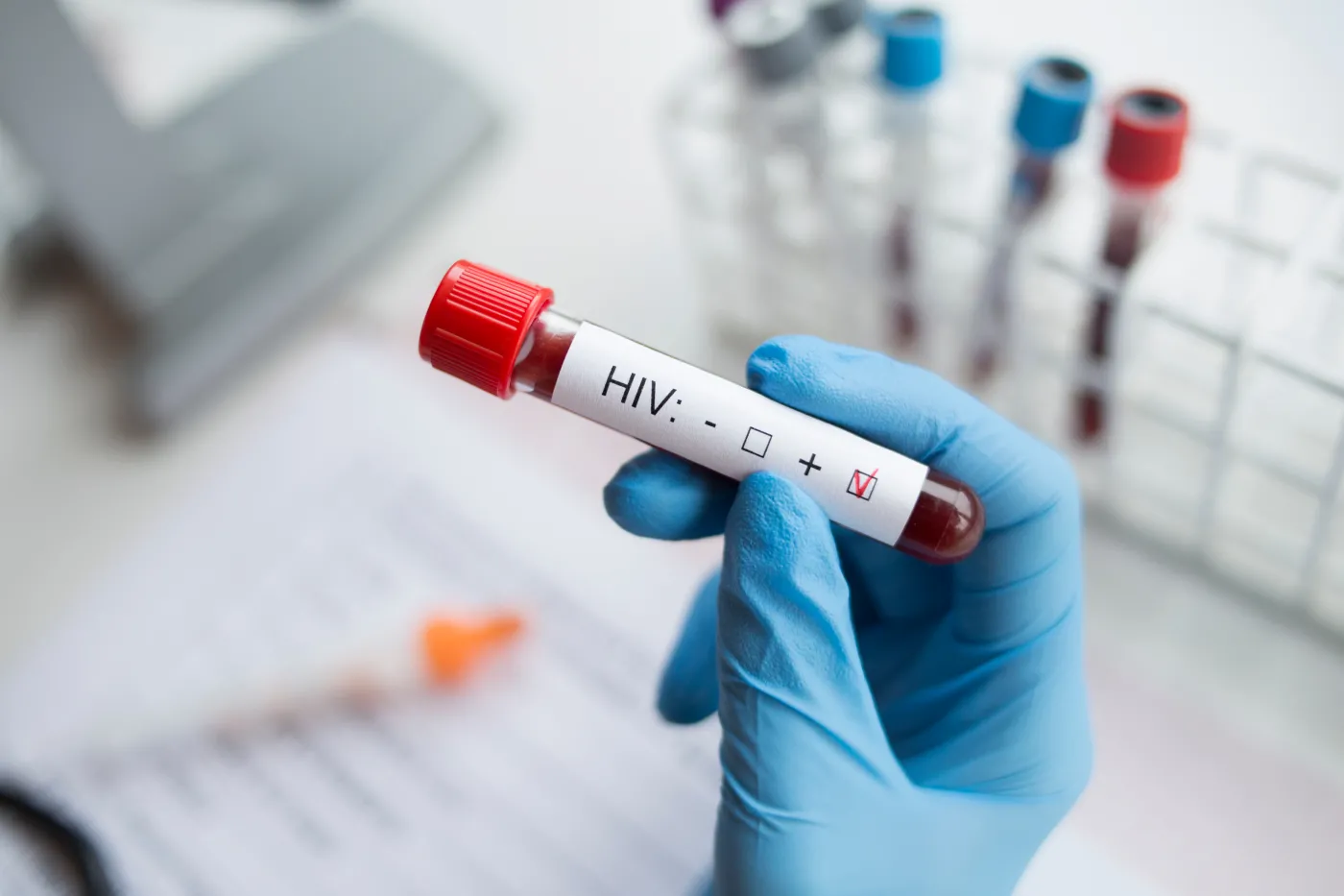 test HIV, wirus HIV, 