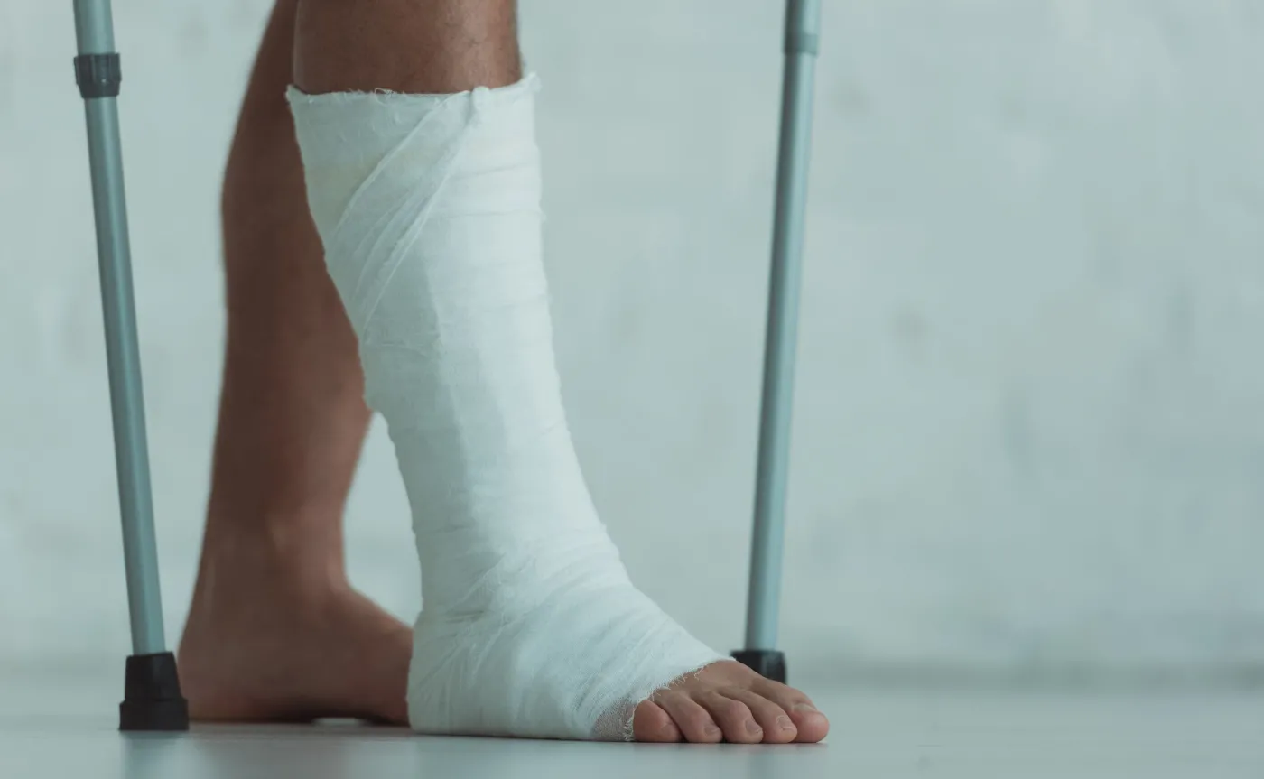 Wypadek podczas prywatnej wizyty w firmie to nie wypadek przy pracy