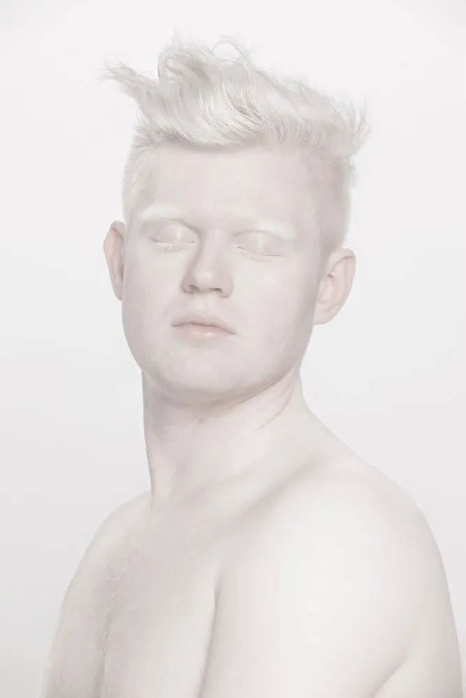Zdjęcia laureatki World Press Photo – Anny Bedyńskiej