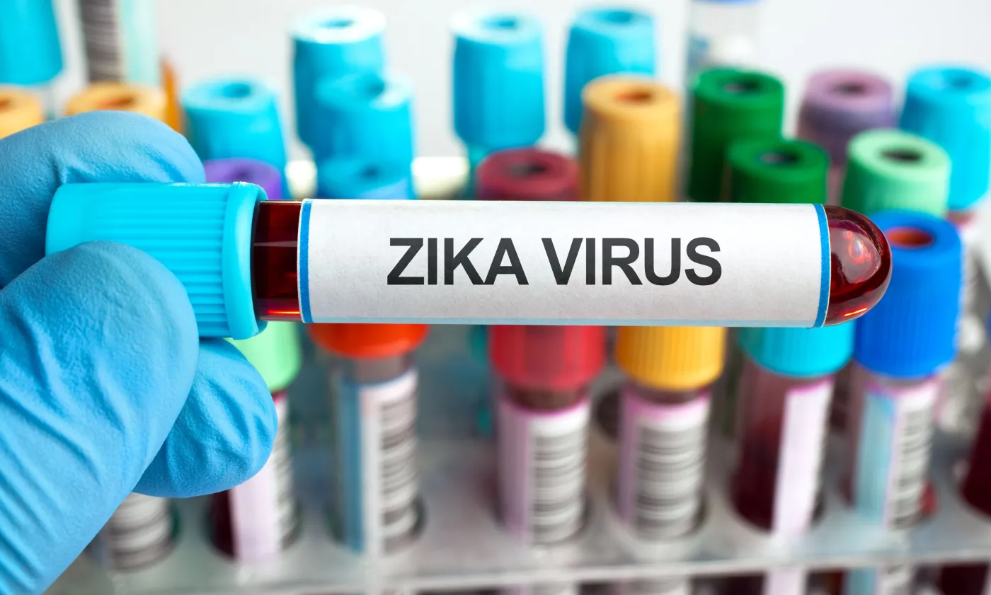 Wirus Zika