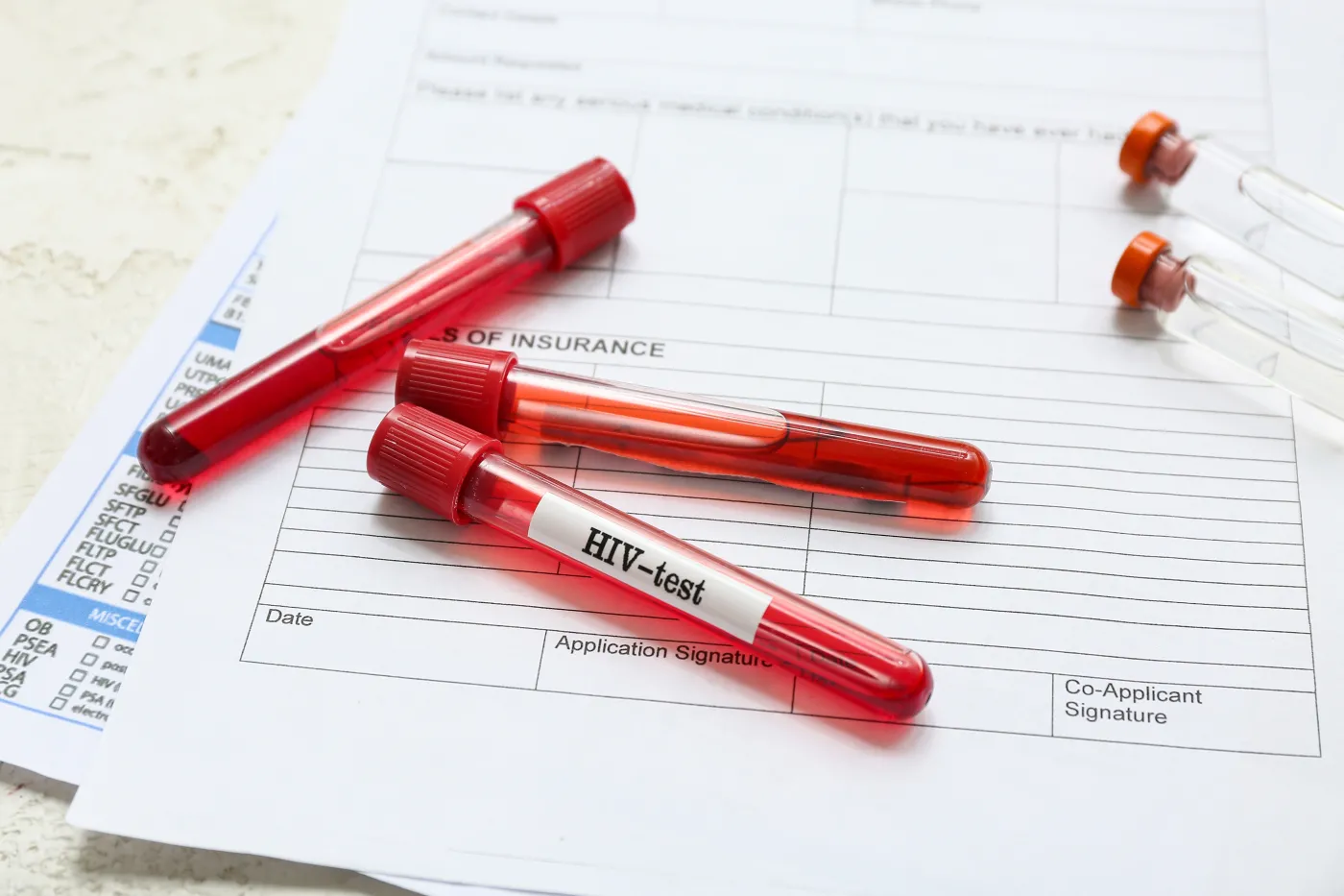 test hiv