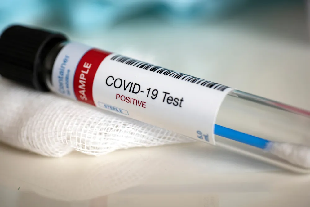 Celon Pharma wstrzymał projekt testów do diagnostyki SARS-COV-2
