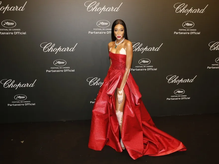 10164444-winnie-harlow.jpg