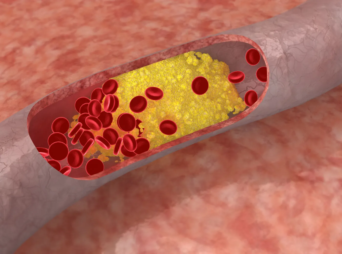 3650162-cholesterol.jpg