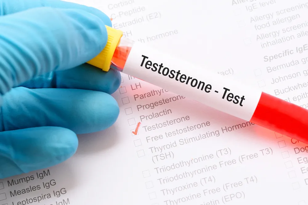 Testosteron – król męskich hormonów. „To ważniejsze badanie niż morfologia!”
