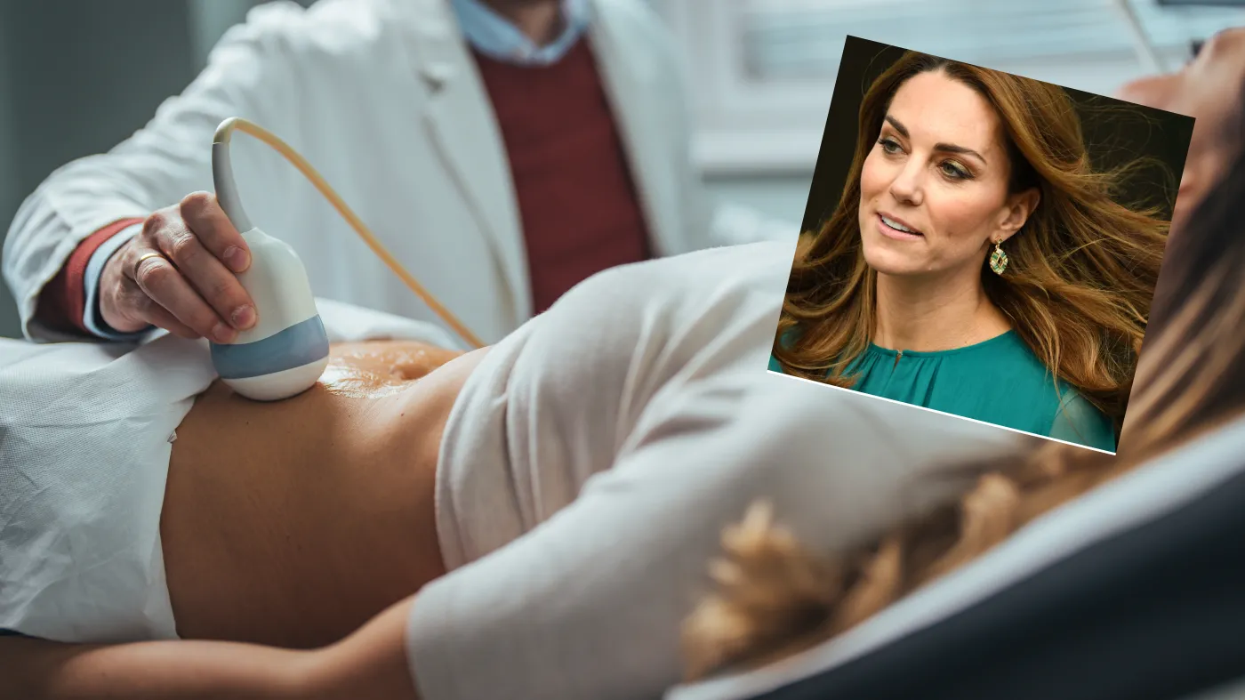 Kate Middleton, rak Kate