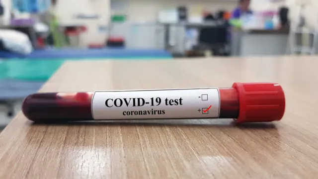 Eksperymentalna terapia nie pomogła w walce z koronawirusem. WYNIKI badań