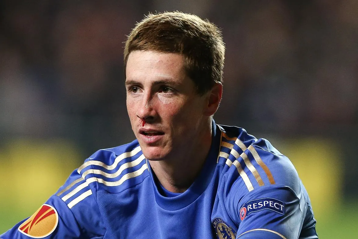 Fernando Torres