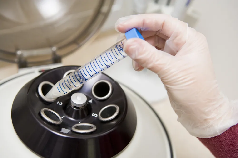 In vitro. Co wiemy o nowelizacji ustawy? Pytania i odpowiedzi
