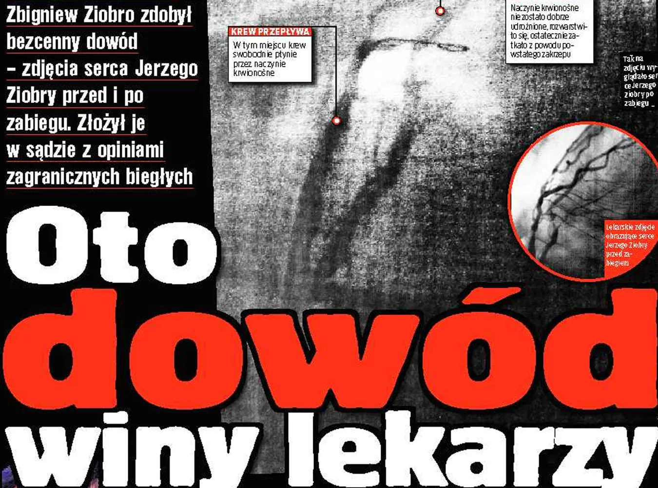 Ziobro: Oto dowód, że lekarze są winni