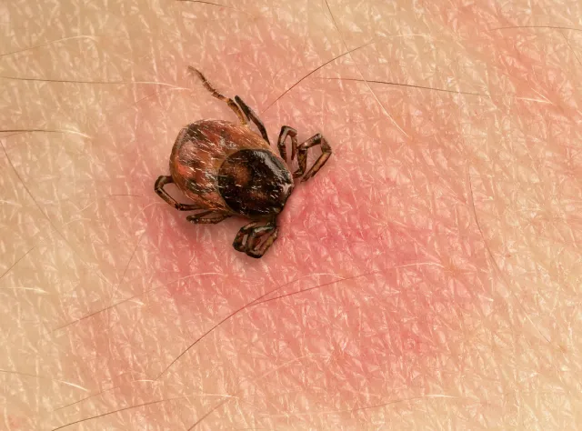 Kto jest najbardziej narażony na ukąszenie przez kleszcza?