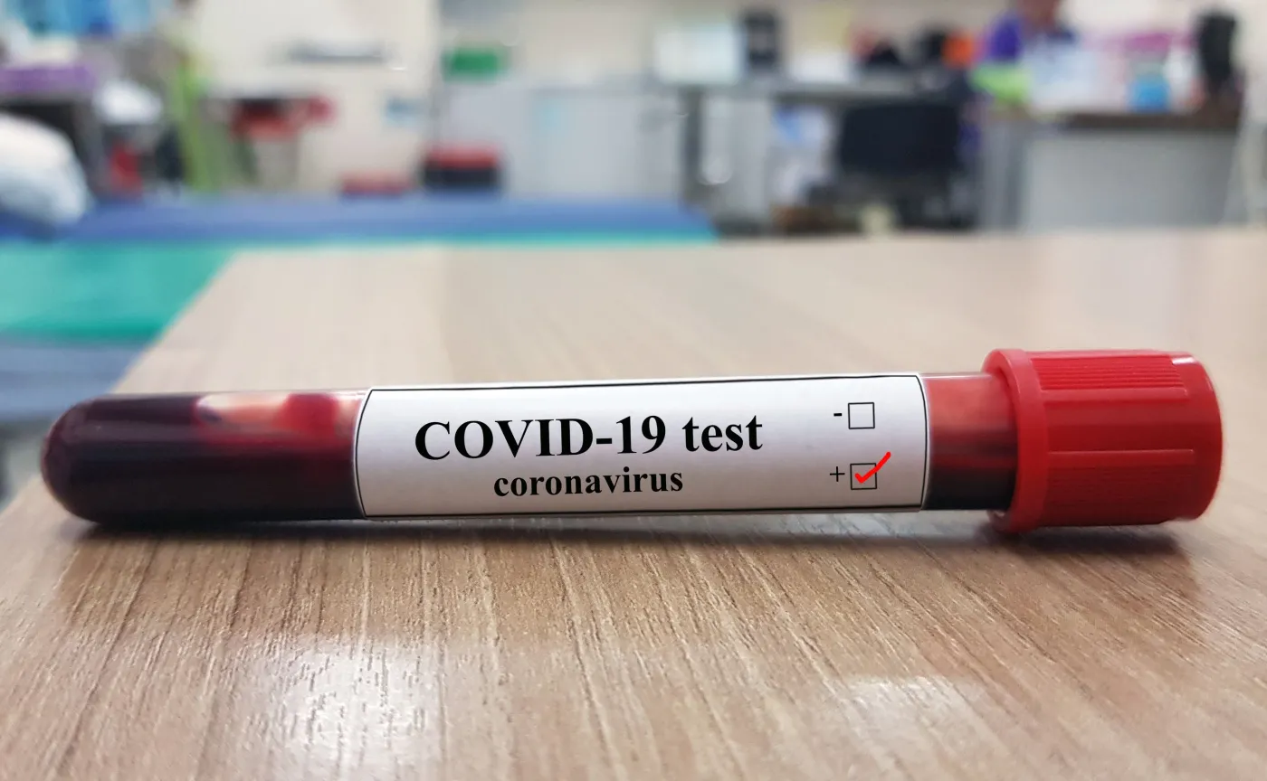 Niepokojące wyniki badań: Część testów na koronawirusa fałszywie pozytywna