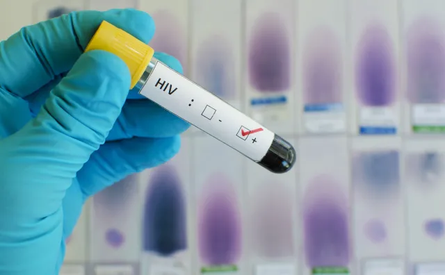 Liczba zakażonych wirusem HIV nadal rośnie. Dlaczego?