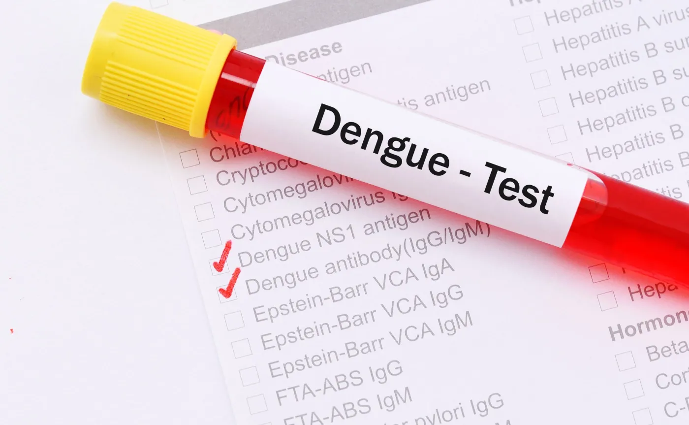 Denga, test na dengę