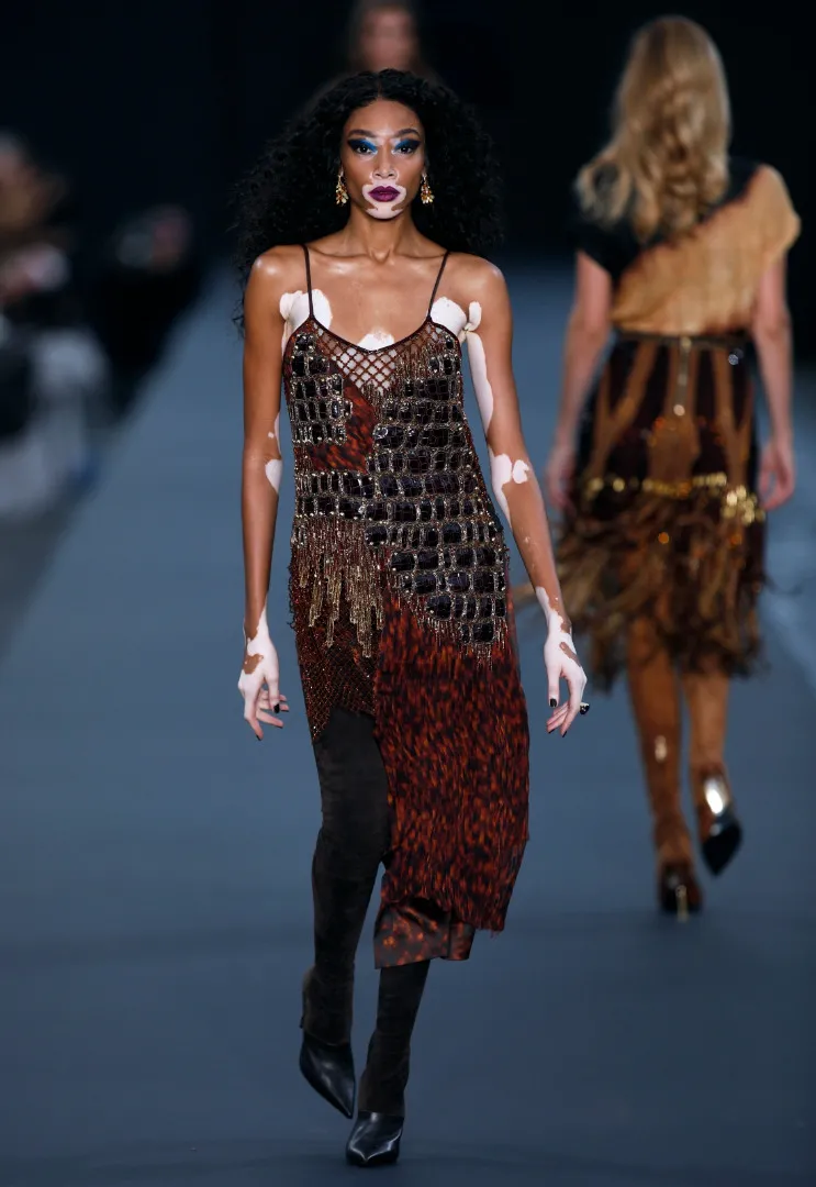 10472591-modelka-winnie-harlow.jpg