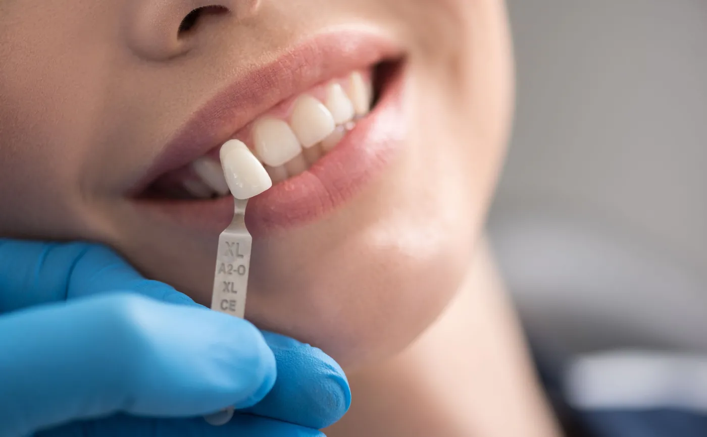 Dopasowywanie implantu