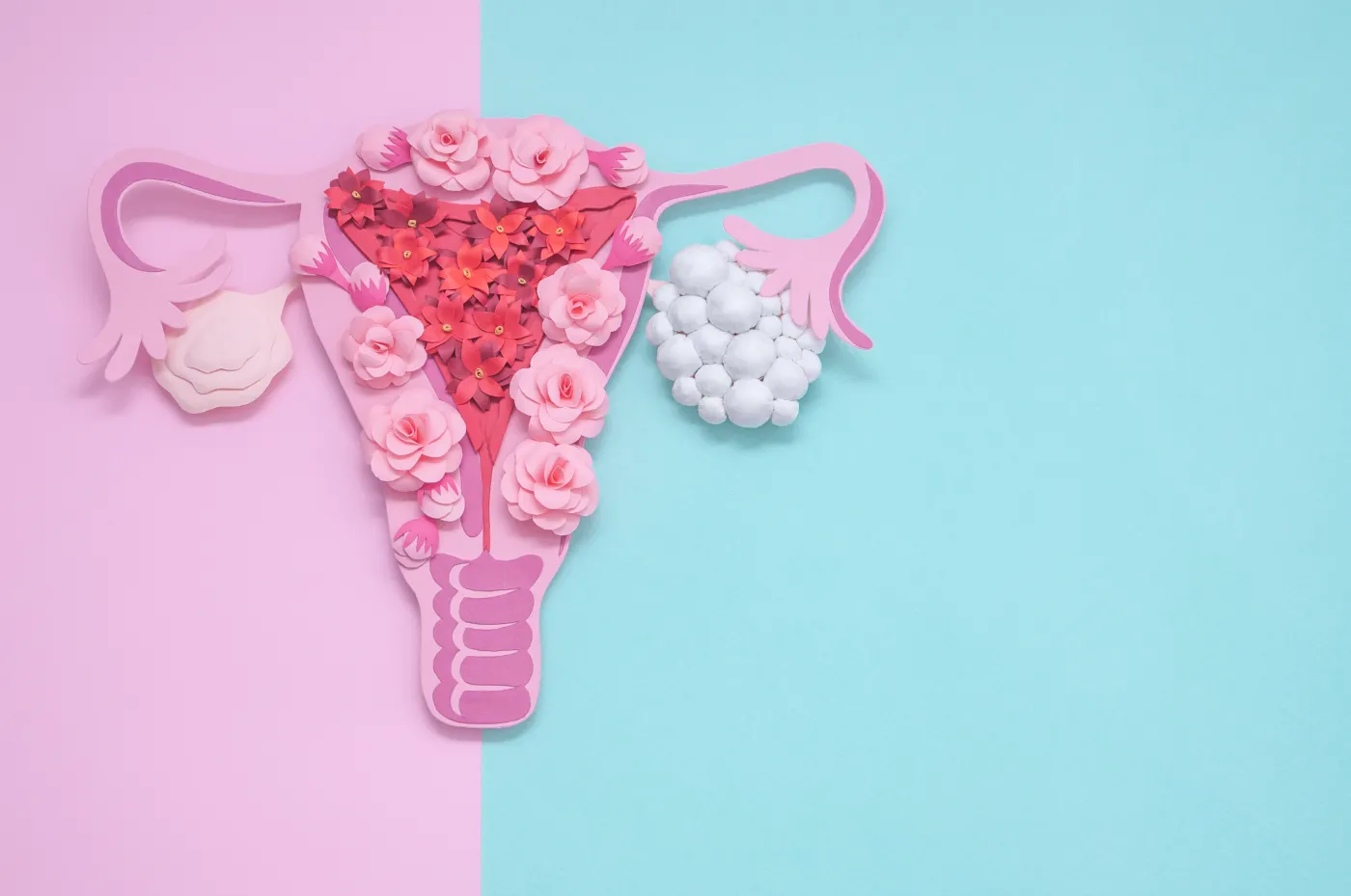 Concept,Awareness,Of,Polycystic,Ovary,Syndrome,,Pcos,,Gynecological,Disease.,Women