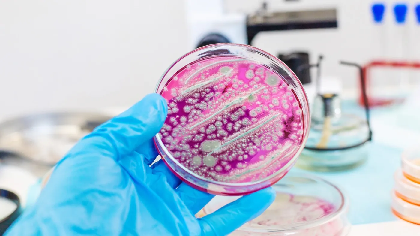Hodowla bakterii w laboratorium. Rzeżączka i narastająca oporność bakterii na antybiotyki