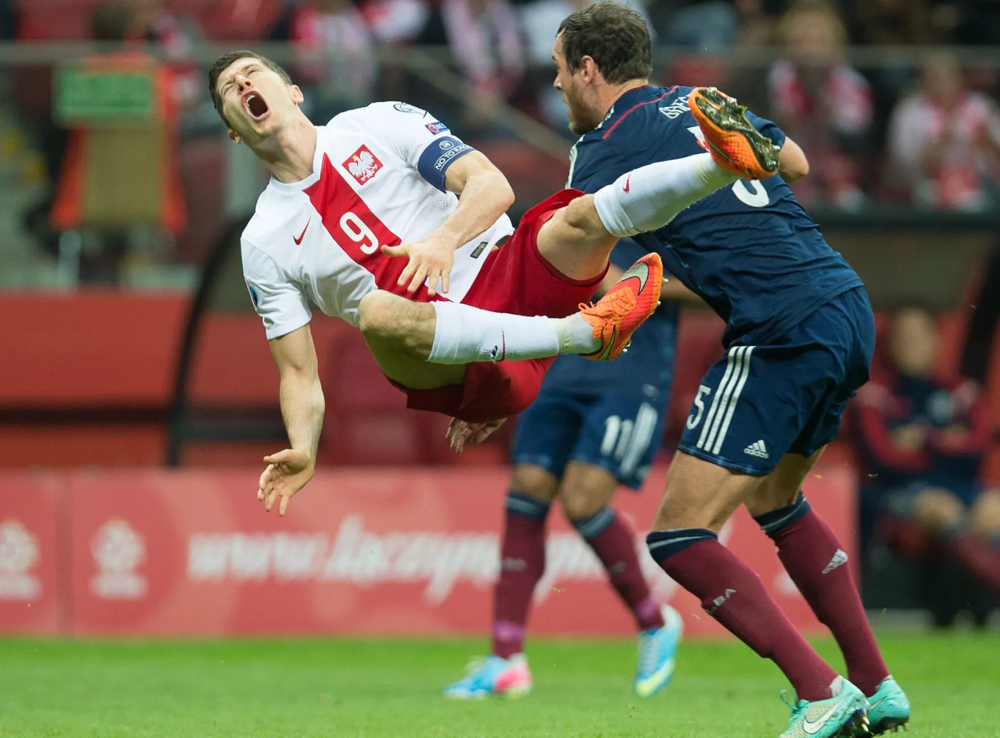 Lewandowski ma dziurę w nodze. Polak ma szczęście, że Greer nie złamał mu kości. ZDJĘCIA