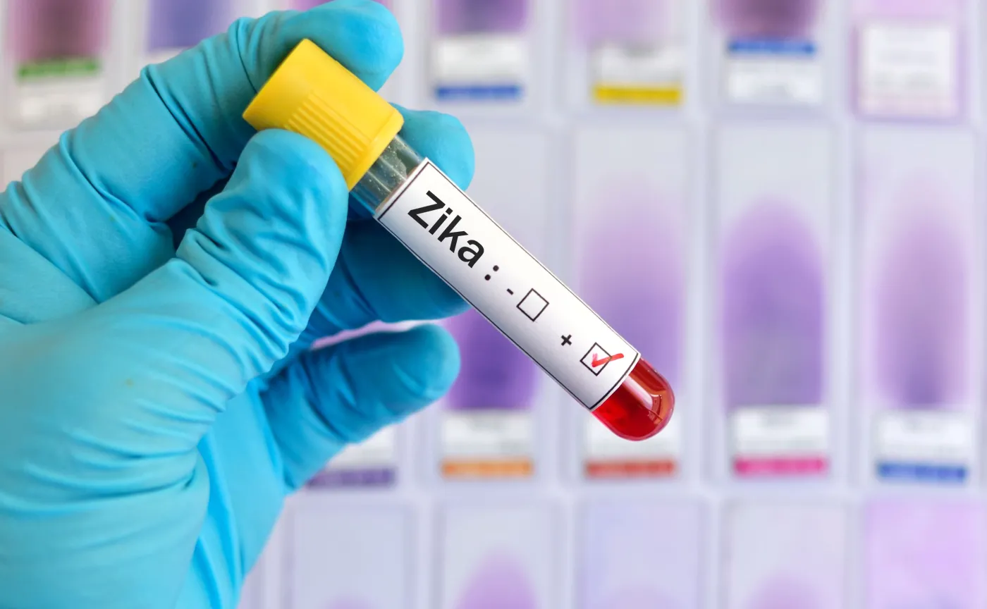 Krew zakażona wirusem Zika