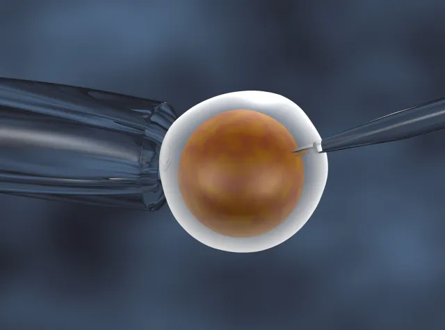 Jakie jest zapotrzebowanie na zabieg in vitro?