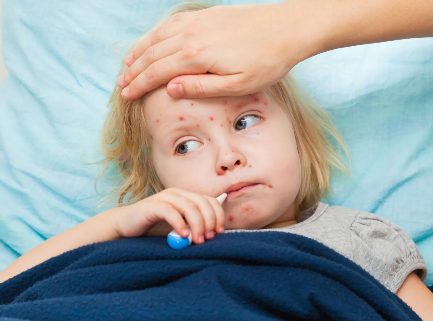 Czy Europie grozi epidemia odry?