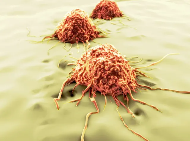 Nowa szczepionka ma zabijać raka. "Przeprogramowaliśmy komórki"