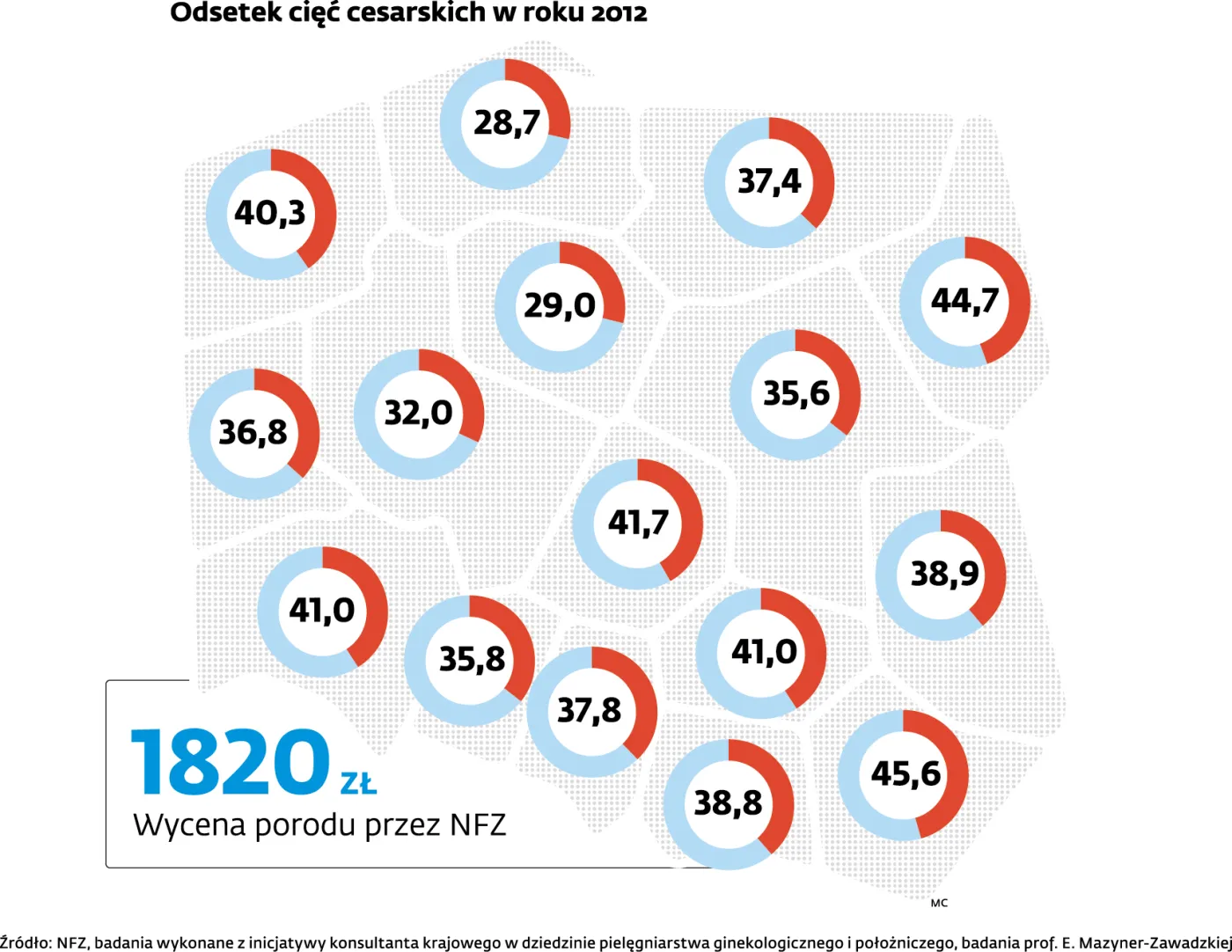 Bezbolesne narodziny dziecka? Resort zdrowia szykuje zmiany