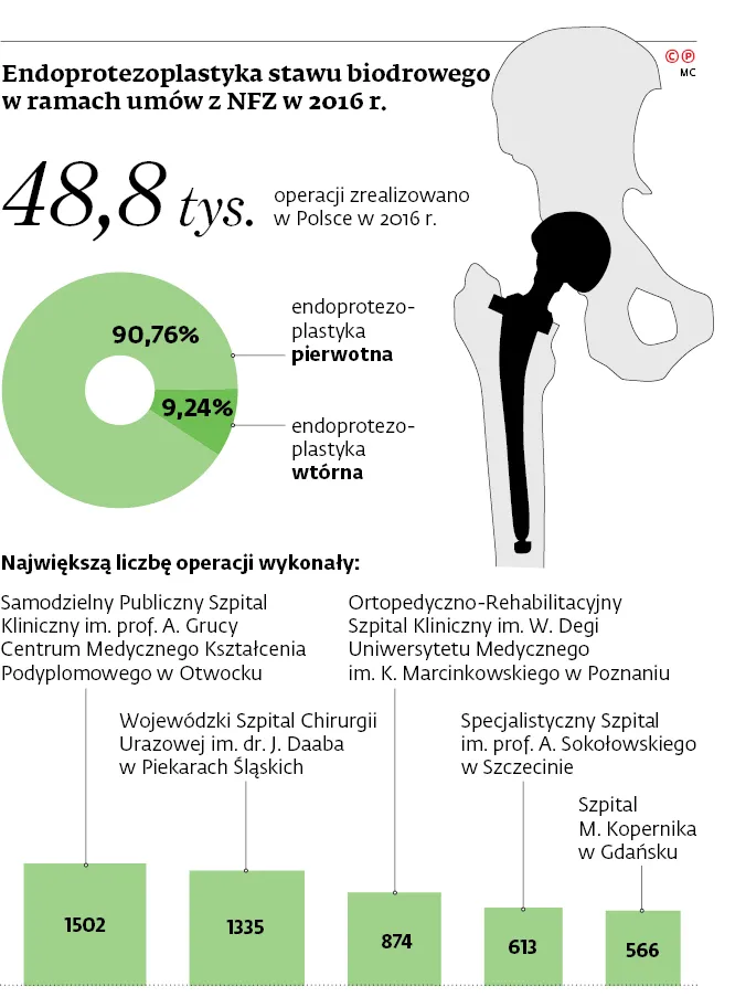 3008787-endoprotezoplastyka-stawu-biodrowego.jpg