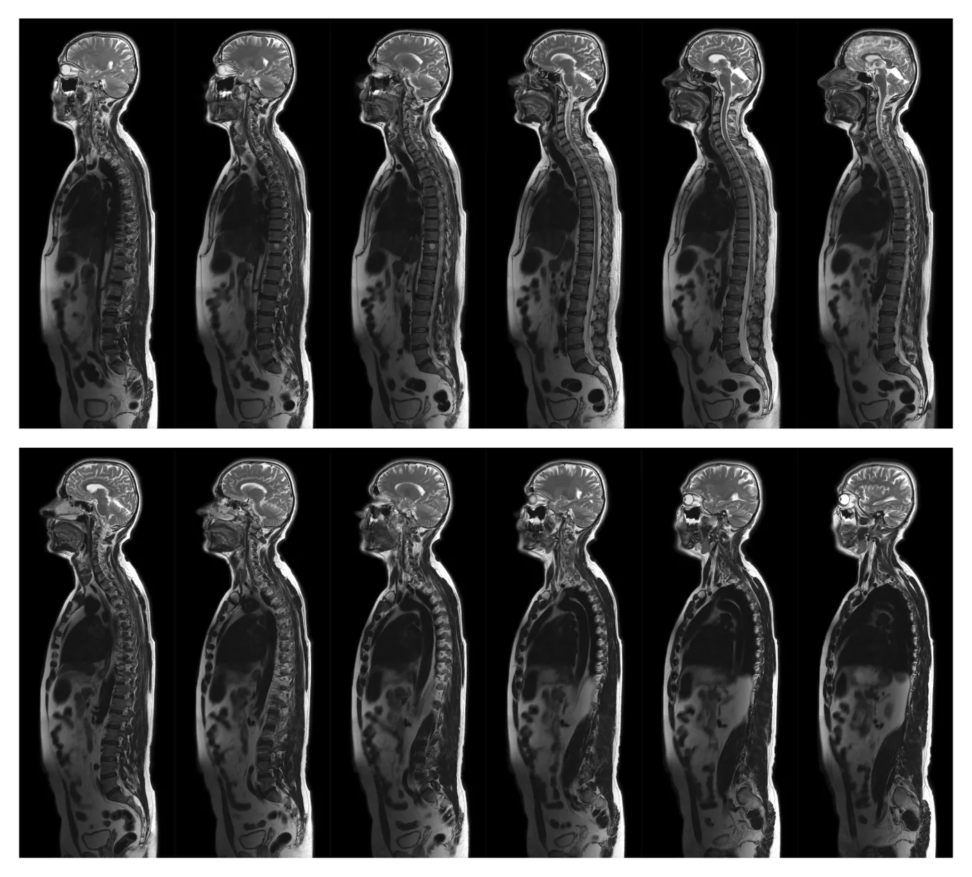 Nerka 500 razy droższa niż żołądek. Ceny organów na czarnym rynku