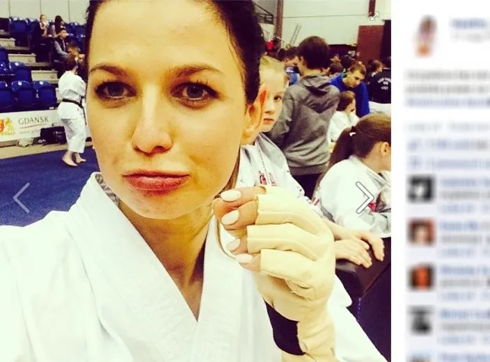 Anna Lewandowska dostała w twarz. Żona piłkarza ma podbite oko i rozciętą wargę