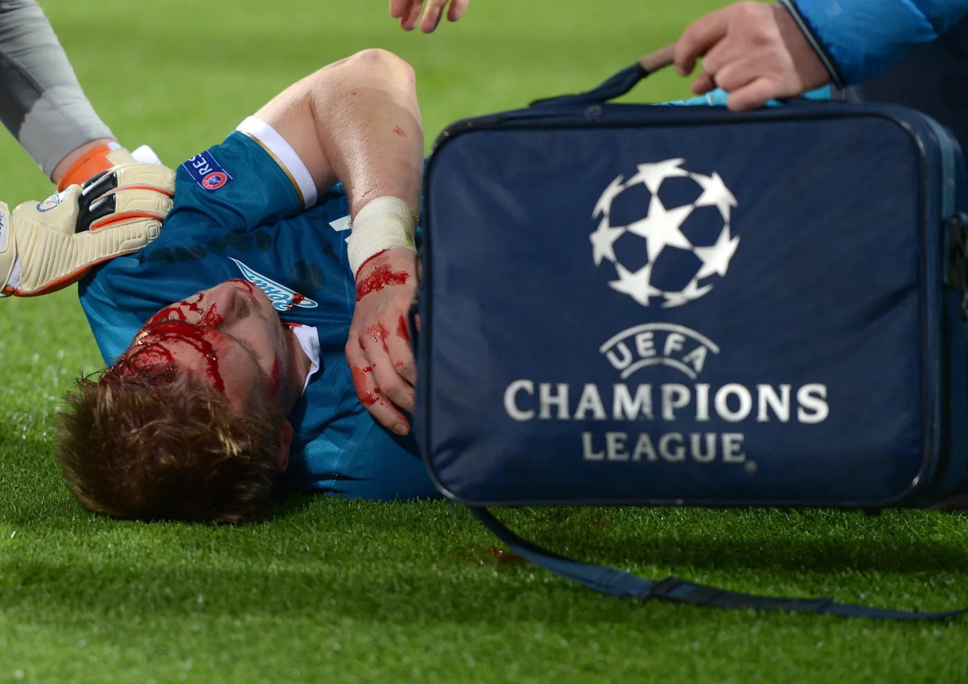 Tak Robert Lewandowski "urządził" rywala. Hubocan zalał się krwią. ZDJĘCIA