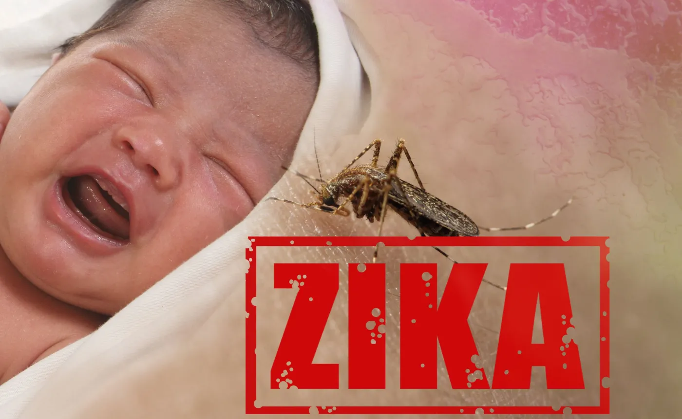 Niemowkę zakażone wirusem Zika