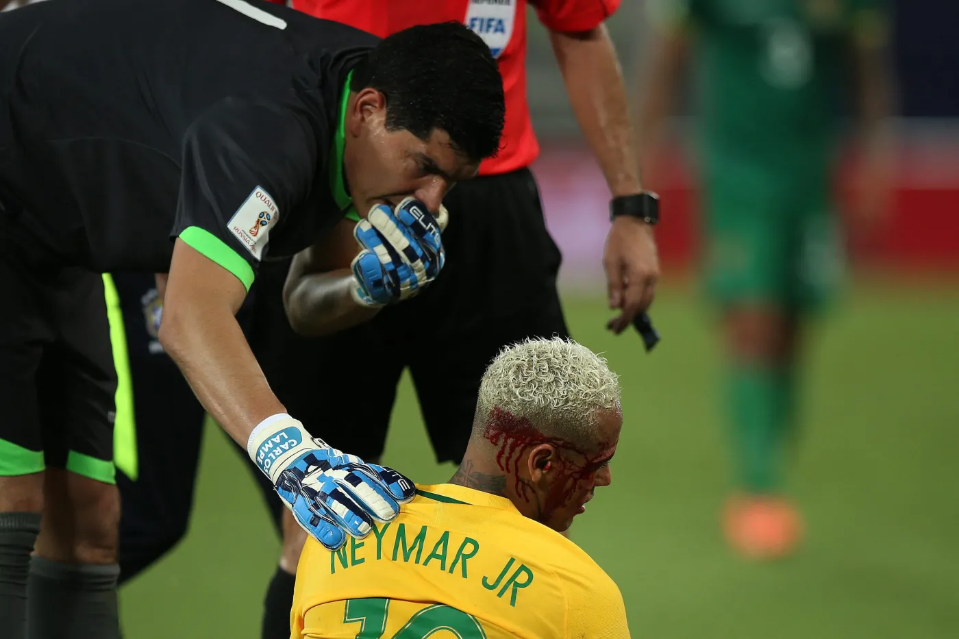 9509969-neymar-dostal-z-lokcia-i-zalal.jpg