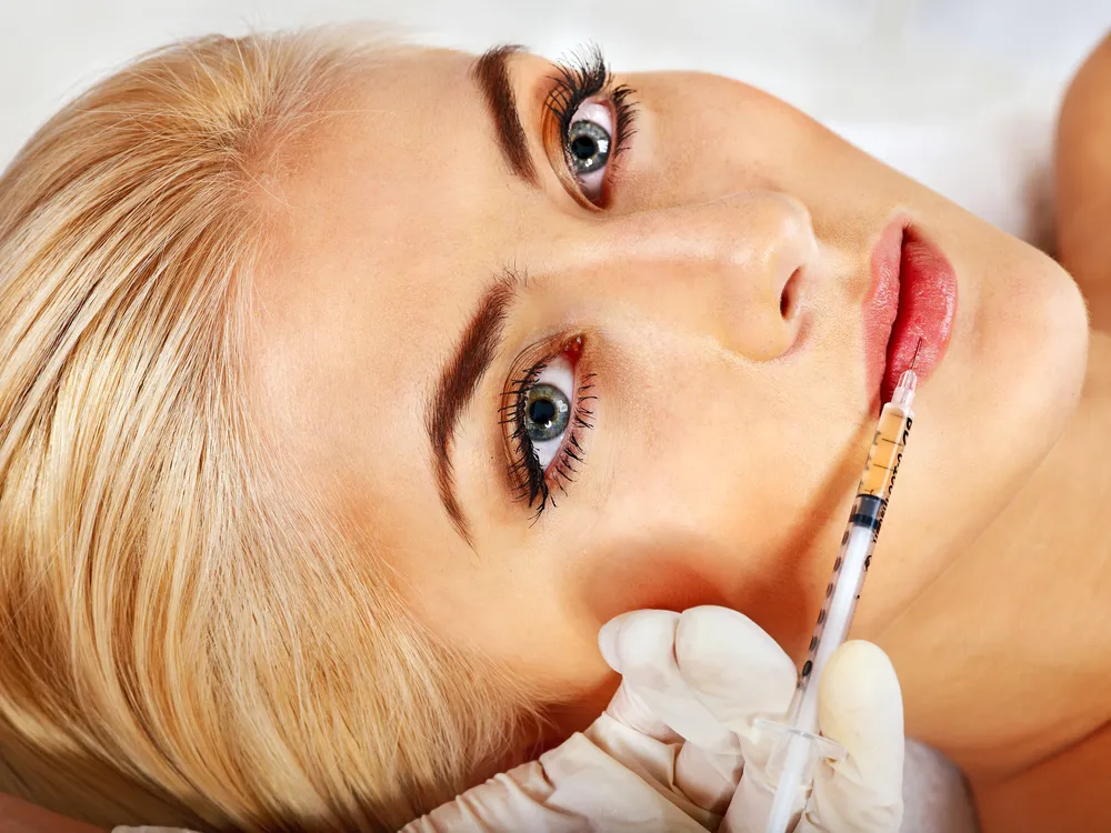 Zabieg powiększania ust botoksem