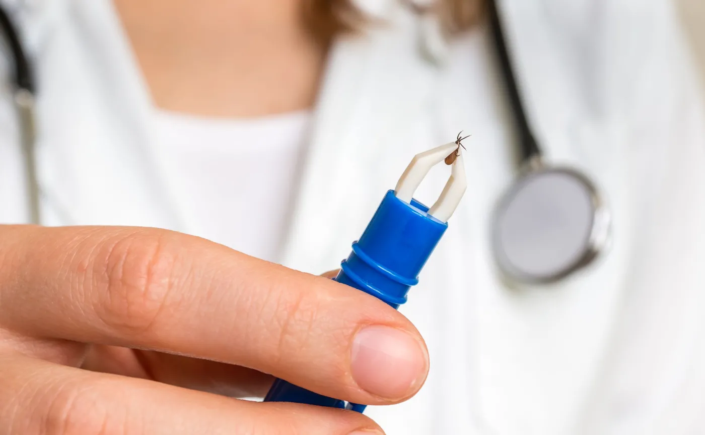 Lekarz trzyma pęsetą kleszcza