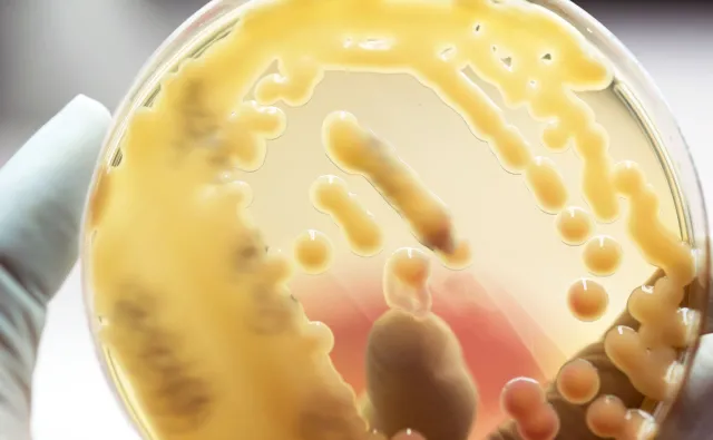 Superbakteria New Delhi - jakie choroby wywołuje?