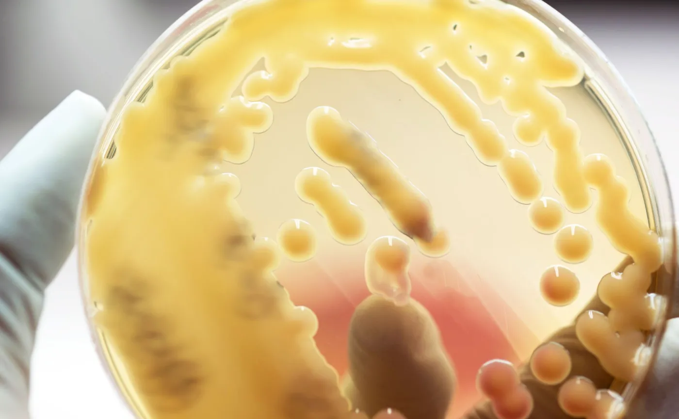 Klebsiella pneumoniae, New Delhi