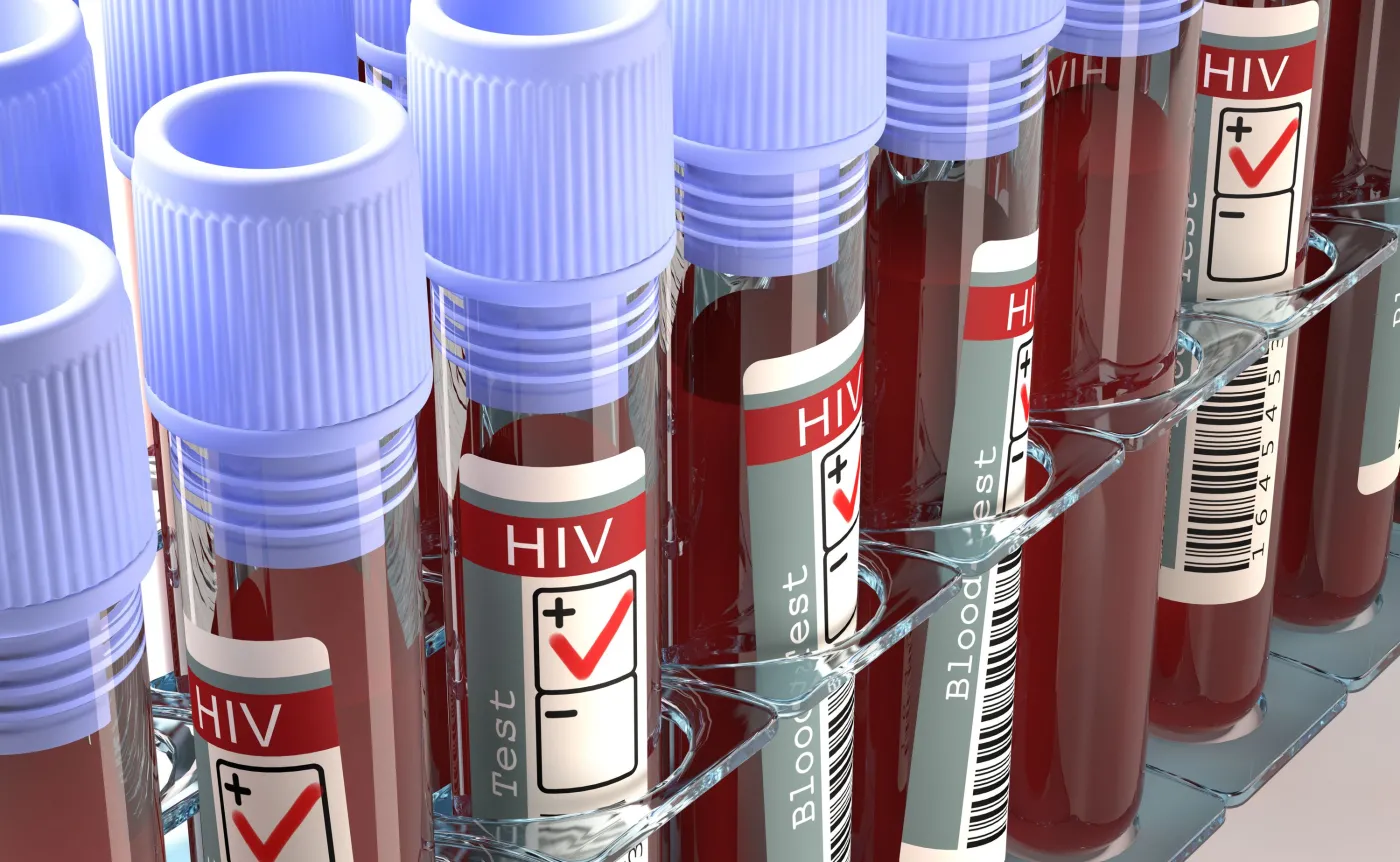Warchoł: Surowsze karanie za narażenie na zakażenie HIV niż koronawirusem jest niesprawiedliwe