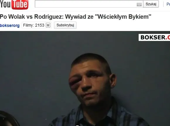 Twarz jak z horroru. Tak rywal "urządził" polskiego boksera