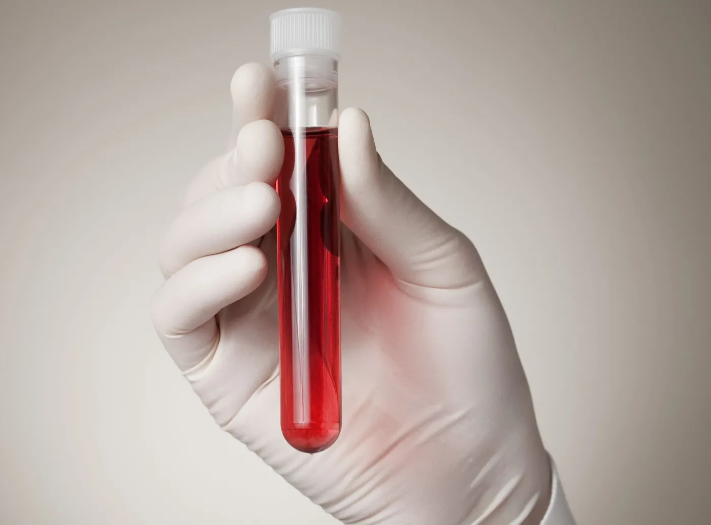 Opanuj anemię - skuteczne leczenie i odpowiednia dieta