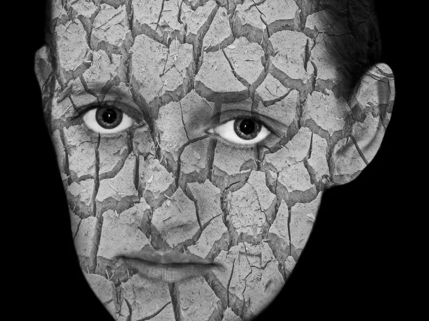 Problemy ze skórą nie dają Ci żyć? Może psychodermatolog pomoże...