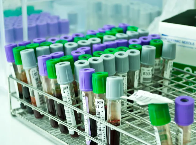 Test z krwi wykrywa raka jajnika