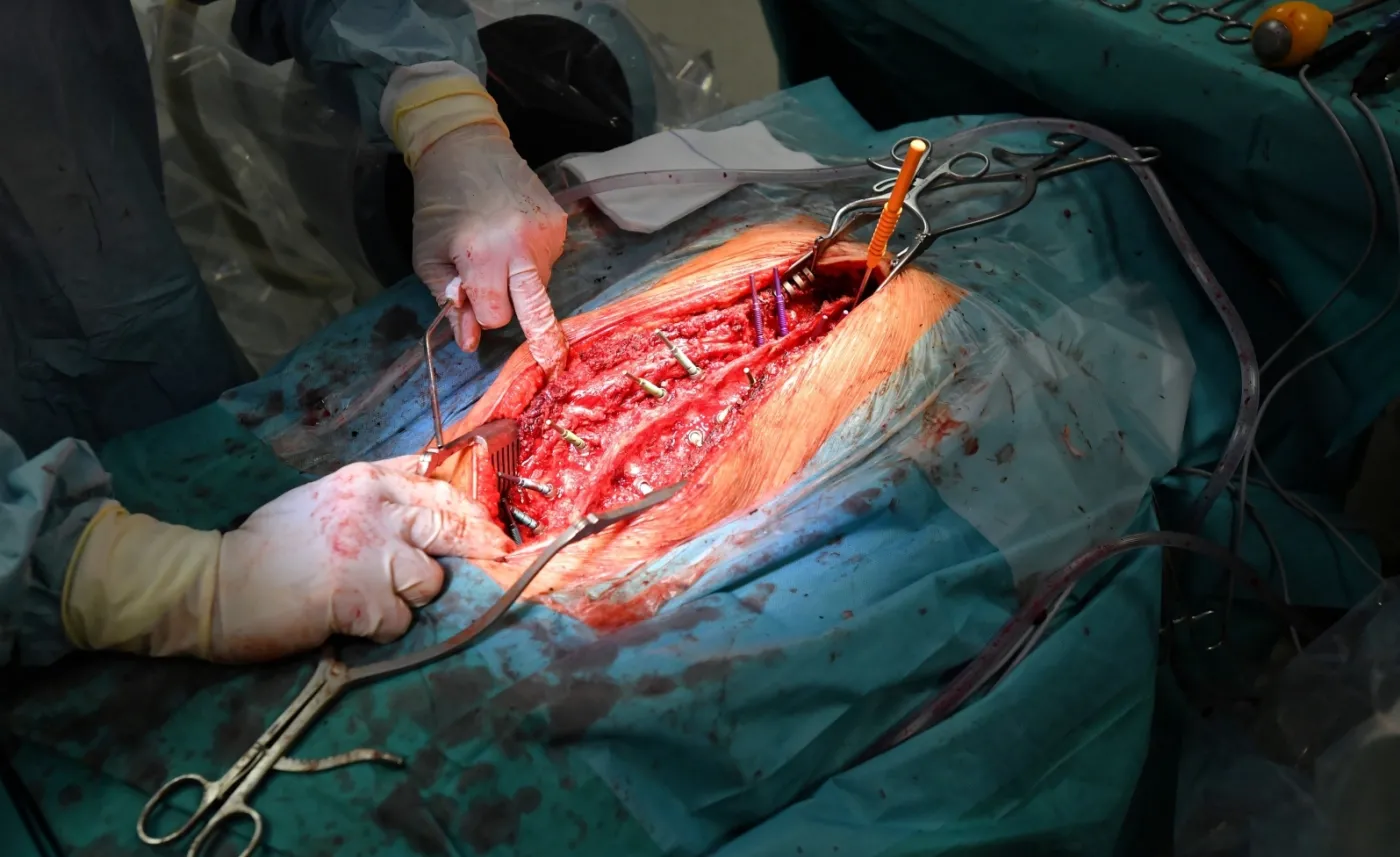 12143024-skomplikowana-operacja-kregoslupa.jpg